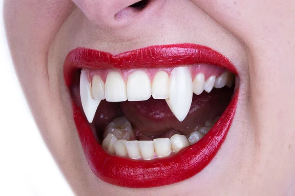 Classic Deluxe Vampire Fangs - Scarecrow - Image 3