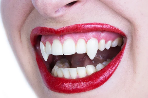 Small Sexy Deluxe Vampire Fangs – Scarecrow - Image 3